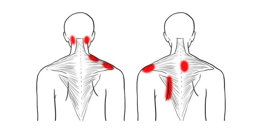 Los 3 mejores ejercicios para el dolor de espalda superior